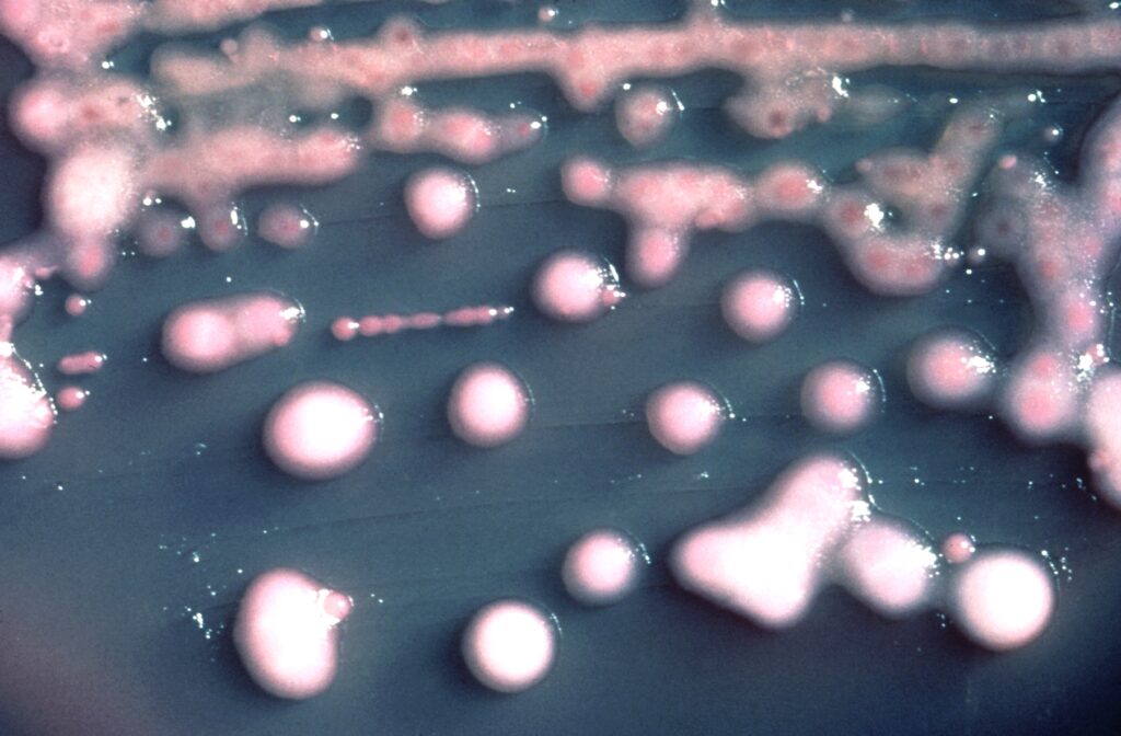 Colonie di Klebsiella pneumoniae su MacConkey agar. - Resistenza antimicrobica