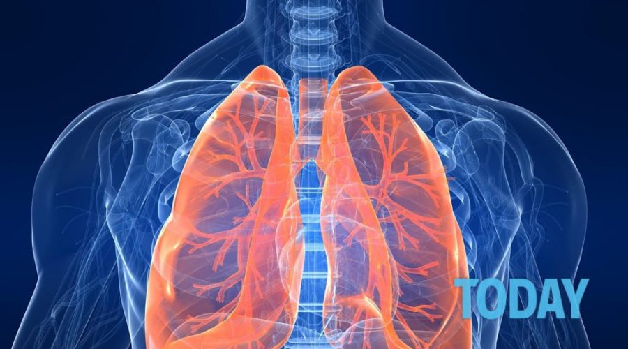 Arriva la Dialisi Polmonare: evita la Respirazione Artificiale