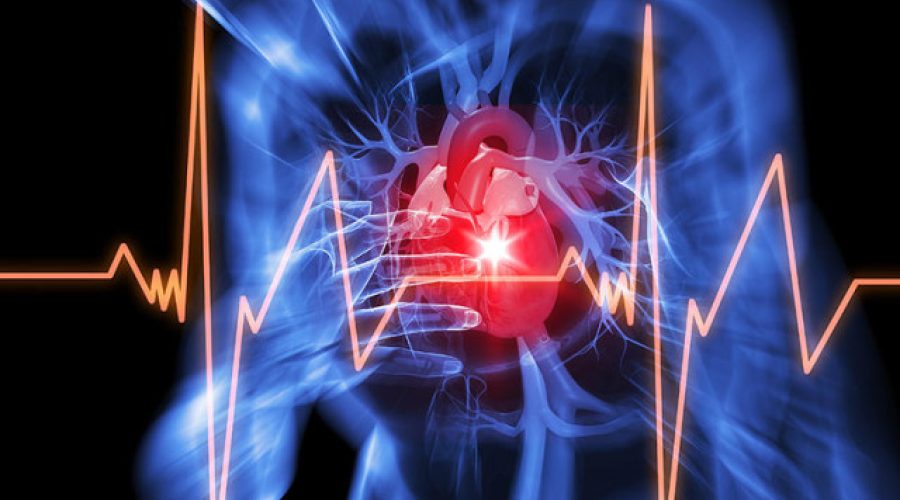 Che cos’è la morte cardiaca improvvisa?
