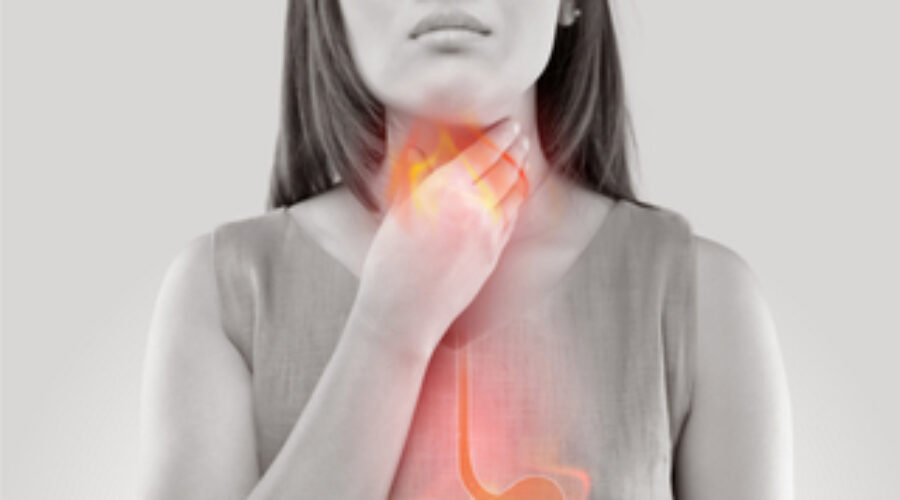Malattia da reflusso gastroesofageo (MRGE): sintomi, diagnosi e cura