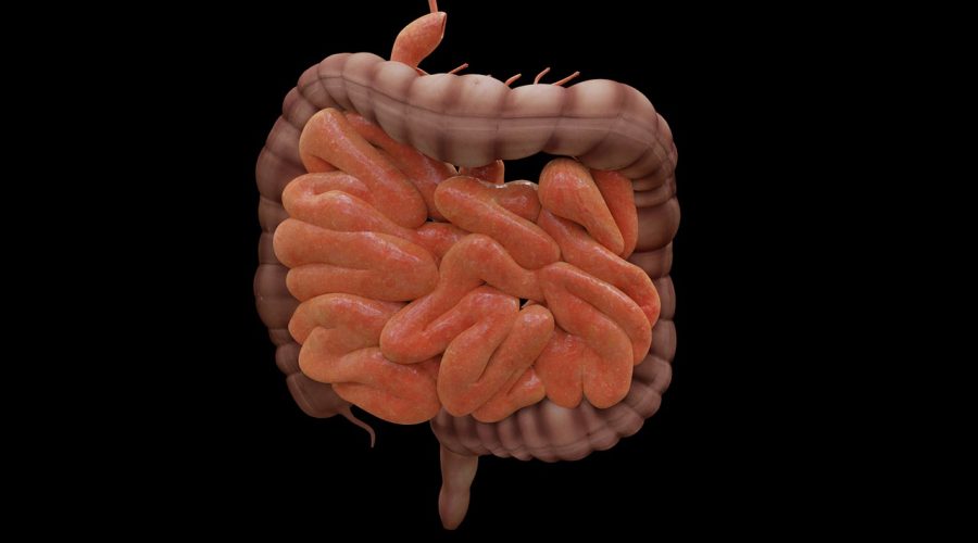 Sindrome dell’intestino gocciolante o leaky gut syndrome