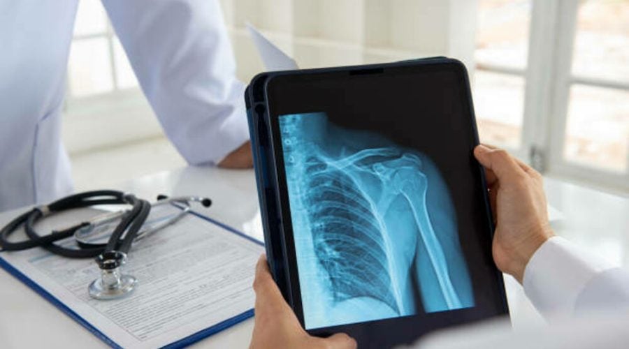ECHOS: il primo dispositivo medico senza radiazioni per la diagnosi precoce dell’osteoporosi
