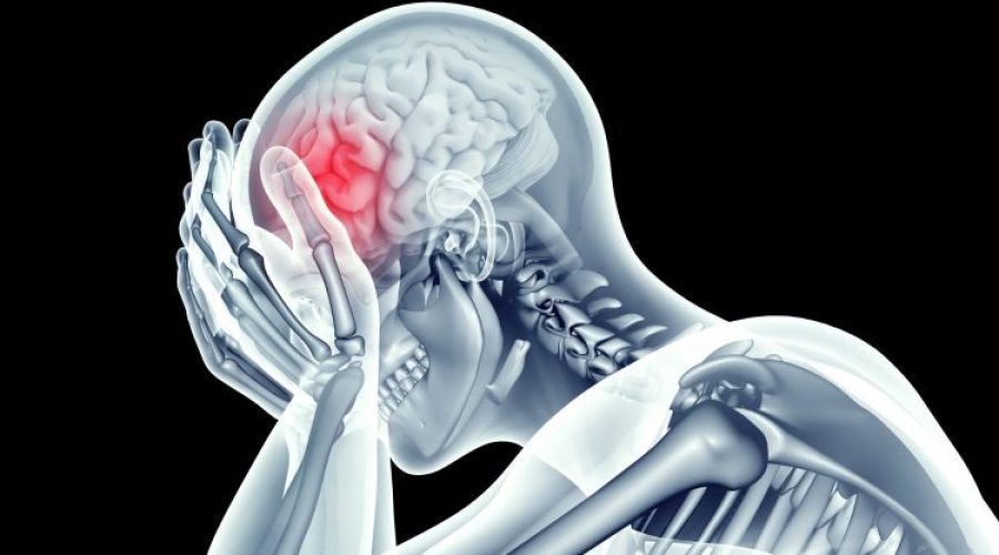 Danno cerebrale: cos’è un ictus ischemico?