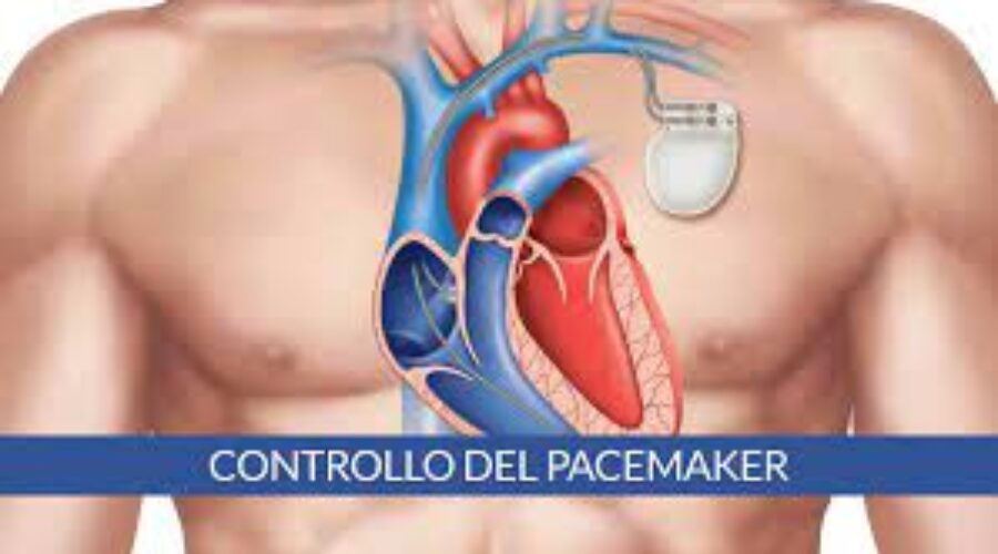 Infezioni ai pacemaker, salvati due pazienti con interventi di cardiochirurgia mininvasiva