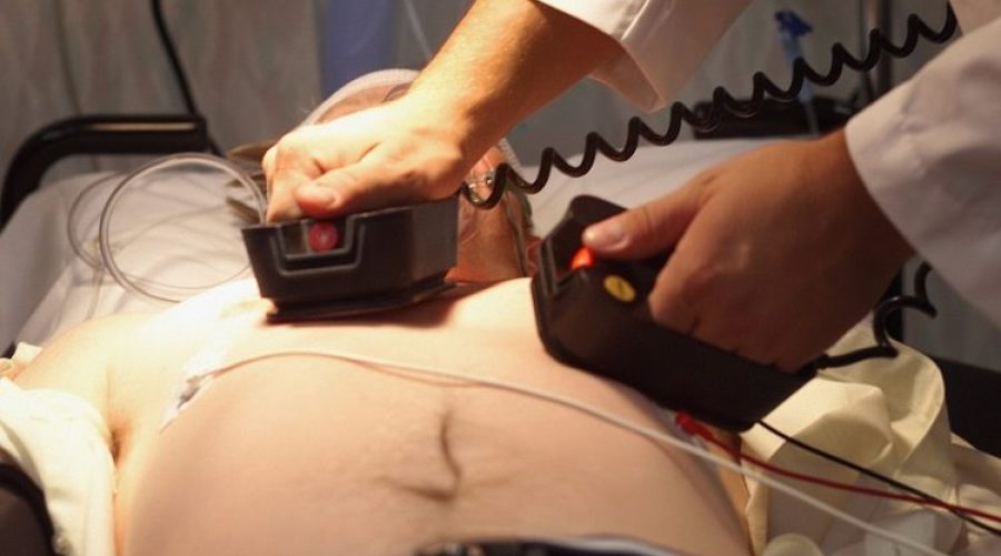 Cardioversione elettrica: che cos’è, quando salva una vita