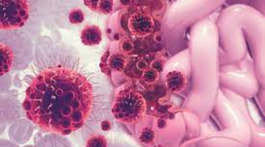 Metastasi del colon retto: dalle cellule senescenti nuovi bersagli terapeutici
