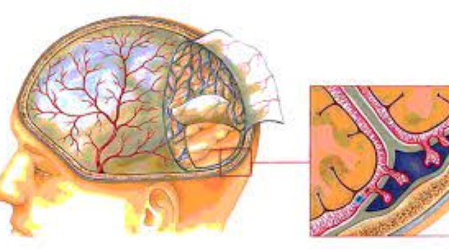 L’embolizzazione dell’arteria meningea media nella gestione dell’ematoma subdurale cronico