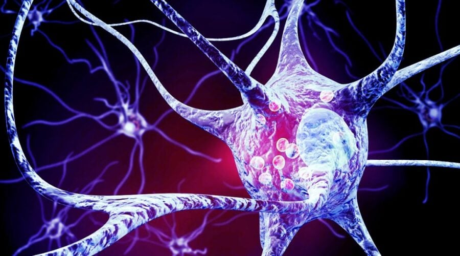 Malattia di Parkinson: scoperto un potenziale legame con l’inquinamento da nanoplastiche