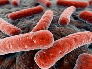 Colera-Cuba-sale-rischio-epidemia