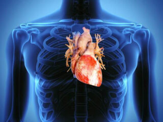 Cuore-Ingrossato