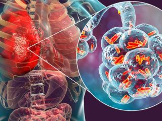 Legionella-Coronavirus
