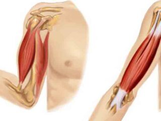 Sarcopenia1160