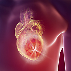 angina
