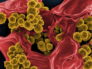 batteri-setticemia
