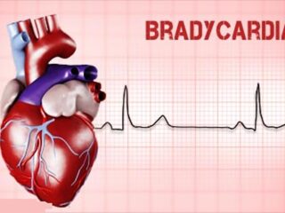 bradicardia-sinusale-che-cose-sintomi-cause-diagnosi-e-possibili-cure