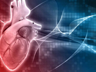 cardioversione