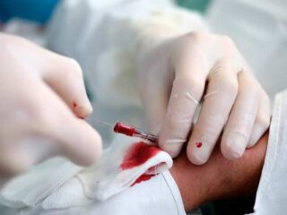 catetere-arterioso-periferico-700×462-1