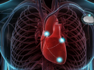defibrillatore-impiantabile-cardiologia-oggi