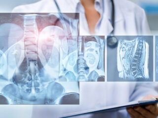 diagnostica