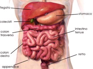 diverticoli