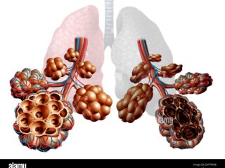 enfisema-come-mancanza-di-respiro-disturbo-polmonare-come-una-malattia-di-bpco-cronica-ostruttiva-polmonare-concetto-medico-come-bronchioli-e-alveoli-2httm0b