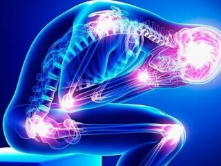 fibromialgia-741×462-1
