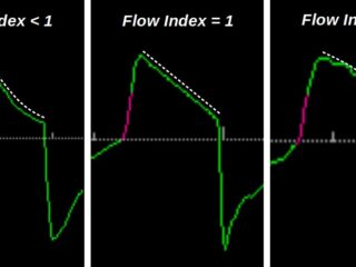 flow_index_3_livelli
