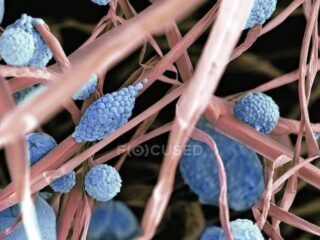 focused_160226744-stock-photo-fungal-cells-with-sporangia-and-650×462-1