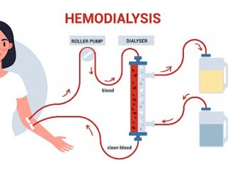 hemodialysis_how-it-works.650×0-is