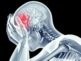 ictus-cervello-Trombosi-cerebrale-dei-seni-venosi-750×430-1