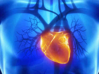 infarto-miocardio_thumb_720_480-1-720×462-1