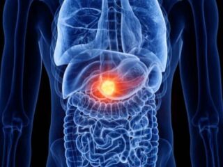 insulinoma-700×462-1