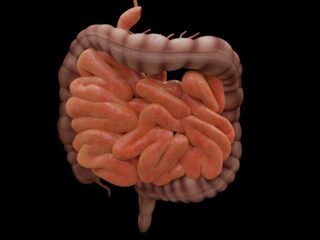 intestino_leaky_gut