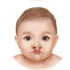 labio