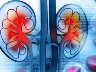 lupus