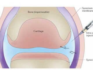 osteoartrite-800×462-1