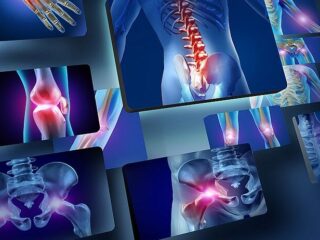 osteoporosiOK-800×462-1