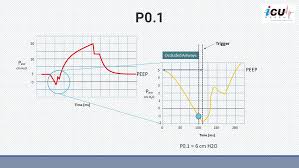 p01