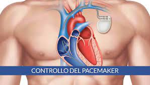 pacemaker-a