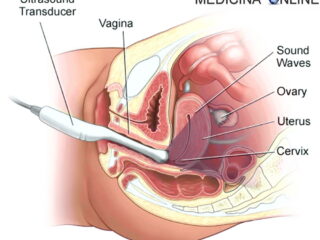 placenta