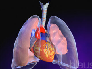 pneumotorace