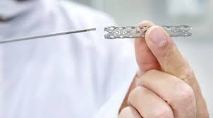 stent