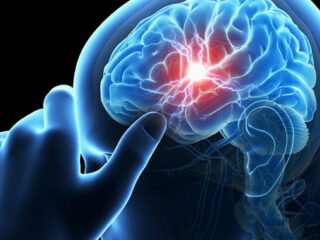 stroke-ictus-678×381-1