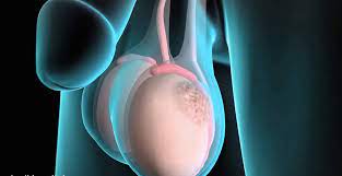 testicolo